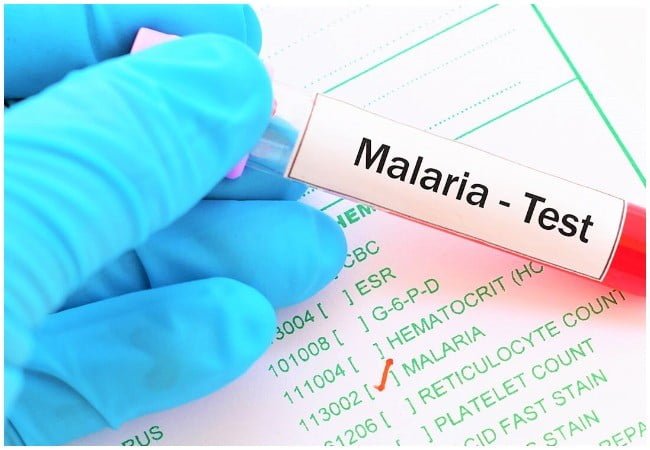 Malaria-diagnosis.jpg