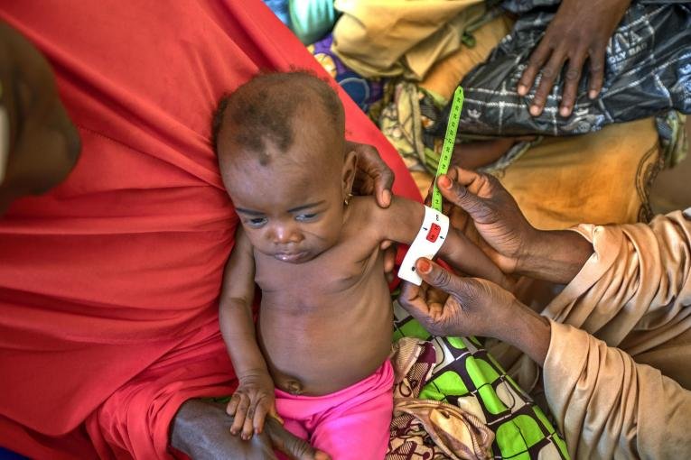 Malnutrition-photo-UNICEF.jpg