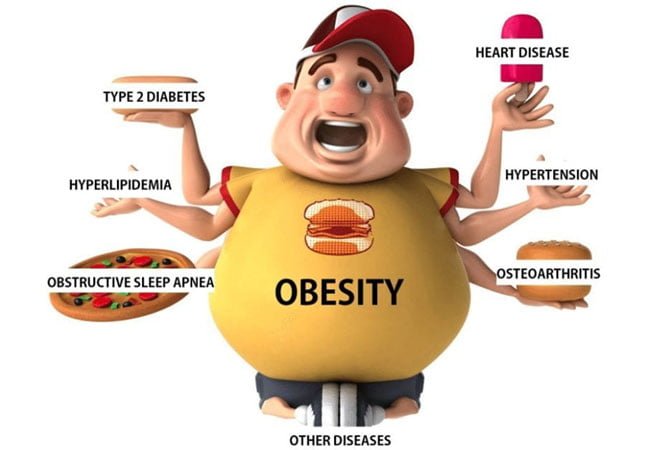 Obesity.jpg