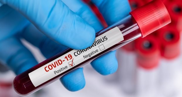 coronavirus-test-620x330.jpg