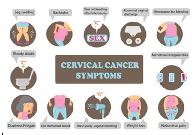 Cervical-cancer-symptoms.jpg