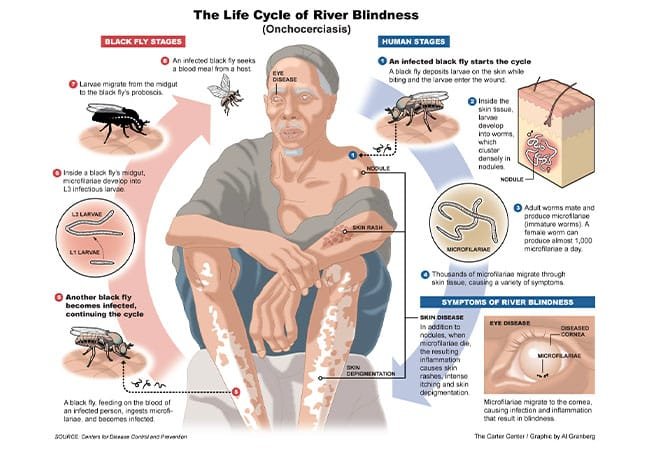 Onchocerciasis-or-river-blindness.jpg
