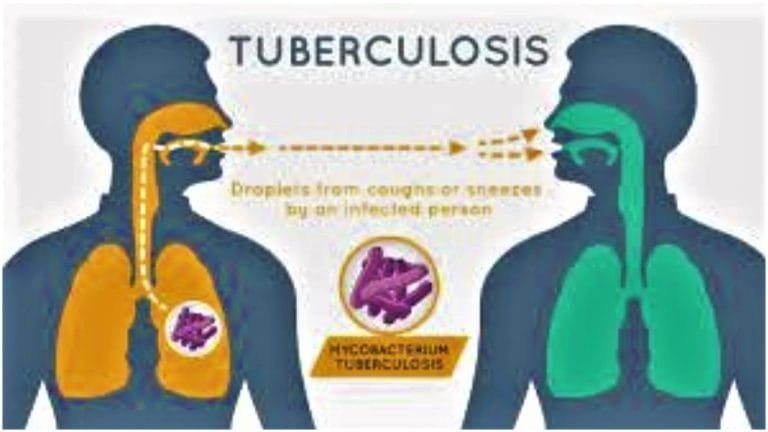 Curbing-TB-spread.-Image-source-Everyday-Health..jpg