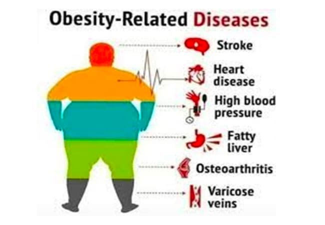 Obesity-related-diseases-2.jpg