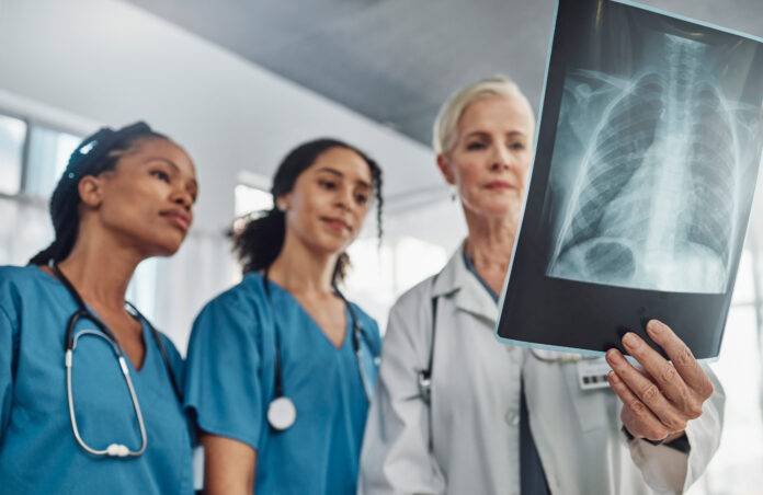 TB-xray.jpg