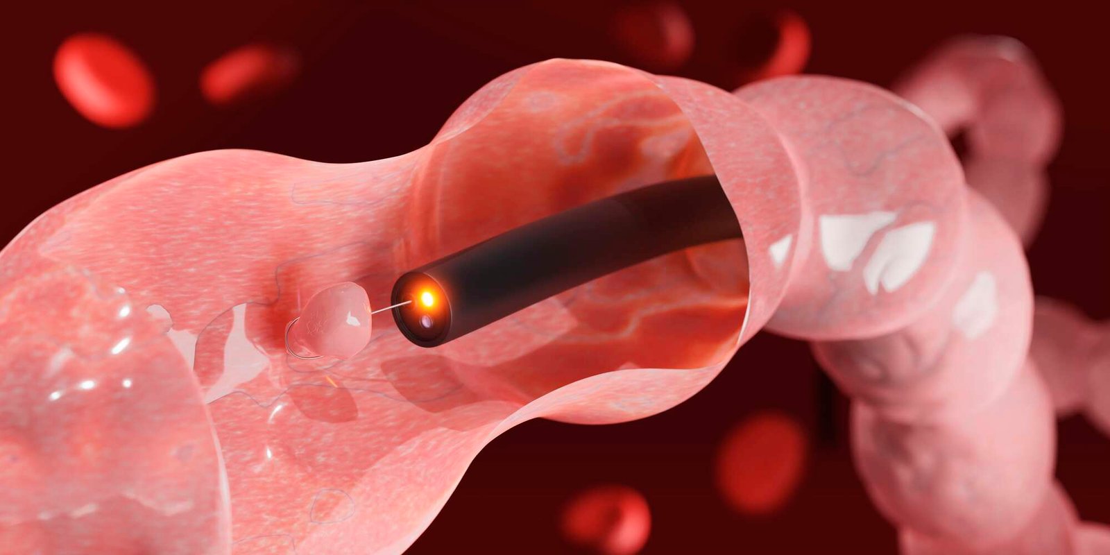 bdendoscopy-data.jpg