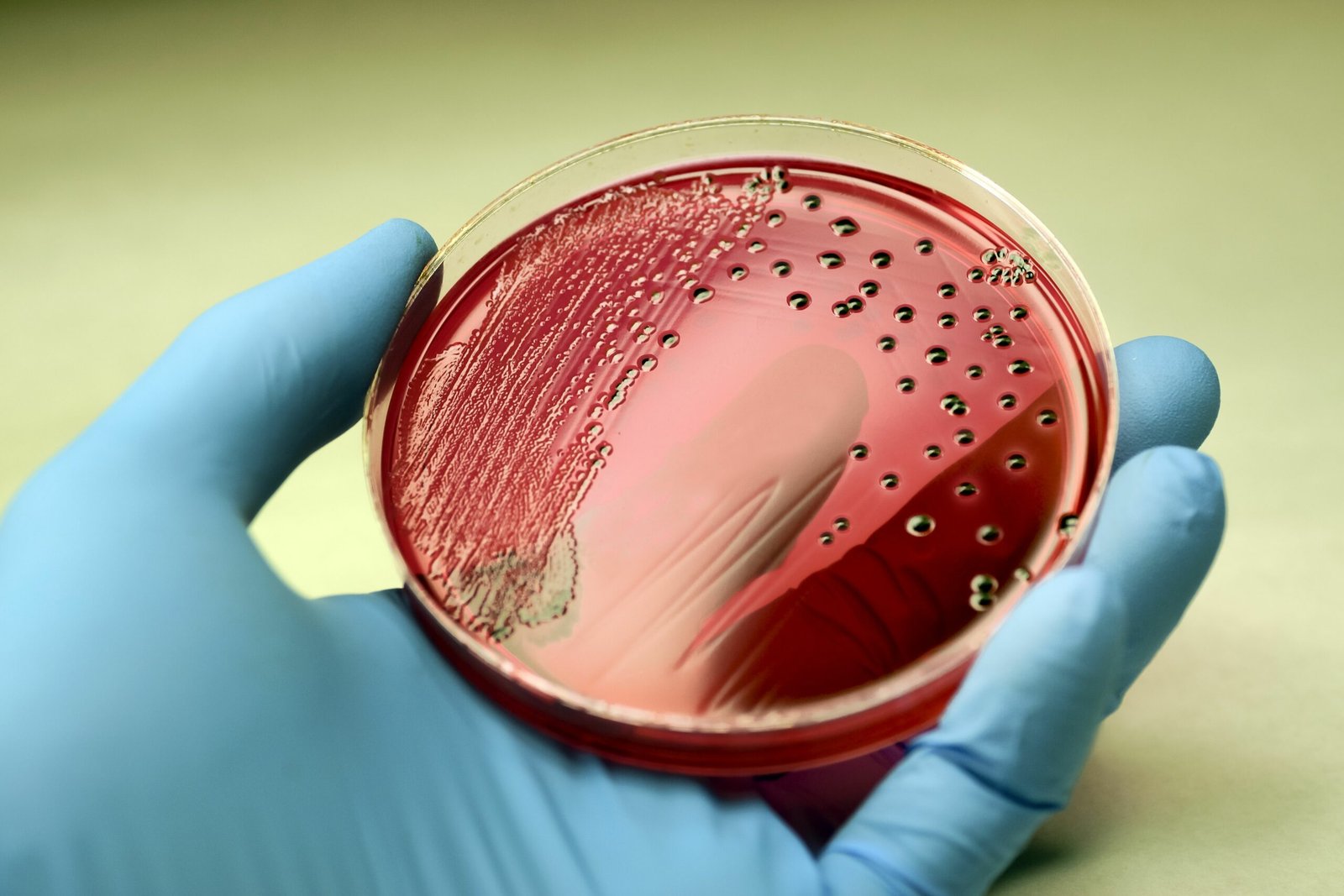 salmonella-scaled.jpg