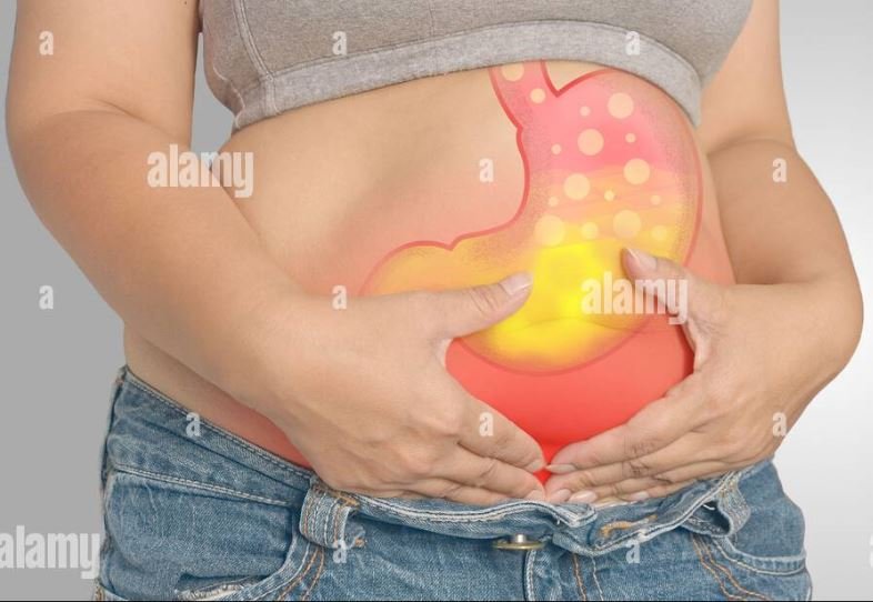 Stomach-acid-burn.jpg