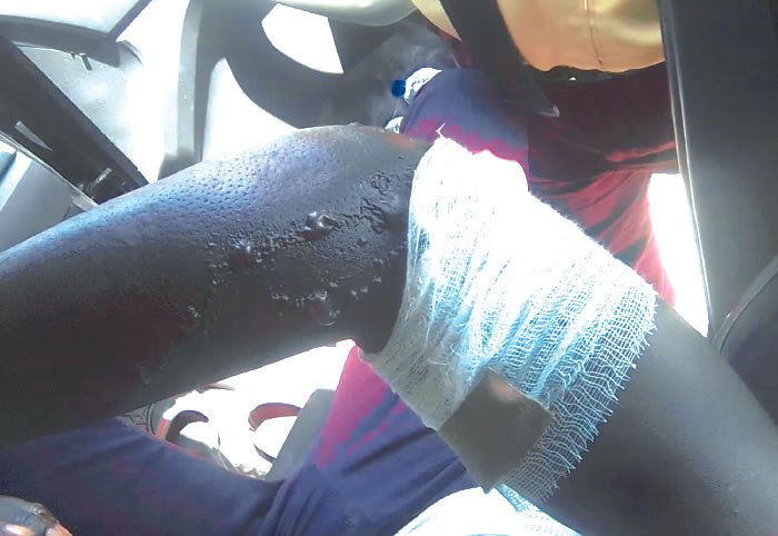 lasema officer injured